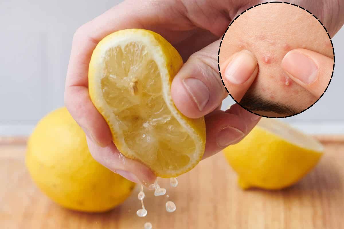 Lemon Juice Side Effects: चेहरे की रंगत छीन सकता है नींबू का रस, ये लोग बिल्कुल न करें इस्तेमाल