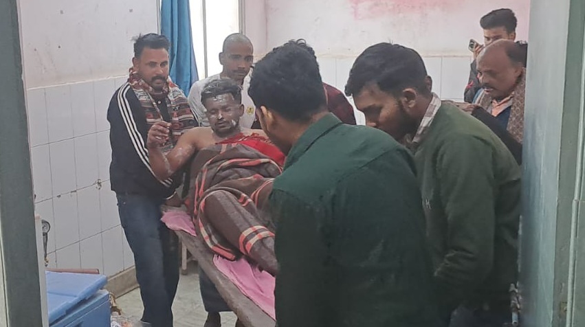 पेट्रोल में आग लगने से दुकानदार झुलसा