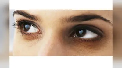 Dark Circles Removal Tips: डार्क सर्कल्स हटाने हैं? आंखों के नीचे काले घेरों के लिए बादाम तेल है असरदार घरेलू उपाय