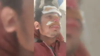 Giridih News :लिफ्ट लेकर बाइक से जा रहा युवक जख्मी