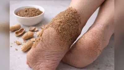 Mungfali Ke chilke Ka foot mask For Cracked Heels: अब फटी एड़ियों की छुट्टी! मूंगफली के छिलके से बनाएं नेचुरल फुट मास्क