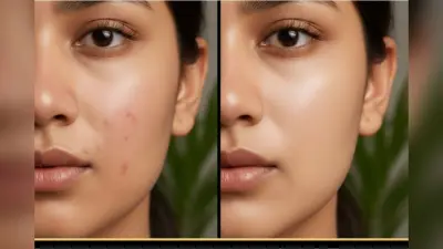 How To Remove Acne Scars: चेहरे पर हैं पिंपल्स के दाग, ये ब्यूटी हैक्स आपको बना सकते हैं बेदाग