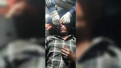मेले से लौट रहे युवक को हाइवा ने मारी टक्कर, दुमका रेफर