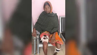 हायना के हमले से महिला घायल