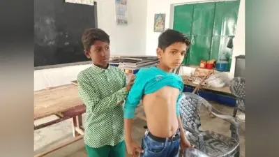 शोभापुर सुखाड़ी विद्यालय में छात्रों को विषैले कीड़े ने काटा, अफरा-तफरी का माहौल