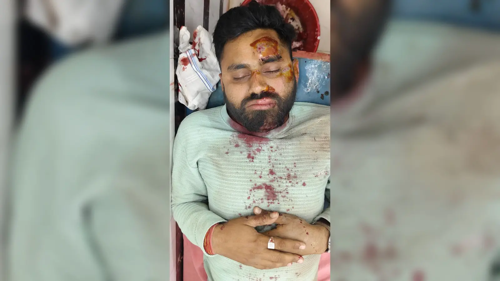 सड़क दुर्घटना में बाइक सवार युवक गंभीर रूप से घायल