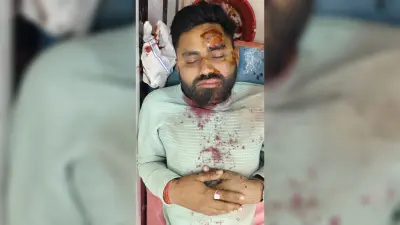 सड़क दुर्घटना में बाइक सवार युवक गंभीर रूप से घायल