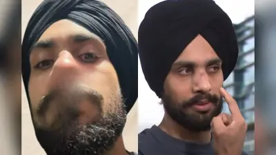 ‘इंडियन डॉग’ बोलकर तोड़ी नाक, ऑस्ट्रेलिया में जिम के बाहर सिख युवक को घेरकर पीटा