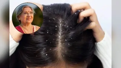 ड्राई स्कैल्प की समस्या से परेशान? डॉ. हंसा जी से जानें आसान घरेलू उपाय और जरूरी टिप्स