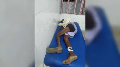 दो बाइक में आमने-सामने की टक्कर, दो घायल