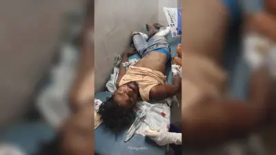 पुलिस के ट्रक से टकरायी बाइक, चालक घायल