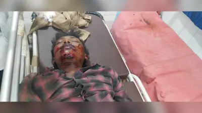 Seraikela Kharsawan News : एनएच-33 और वन-वे पुल पर हादसों में तीन की मौत