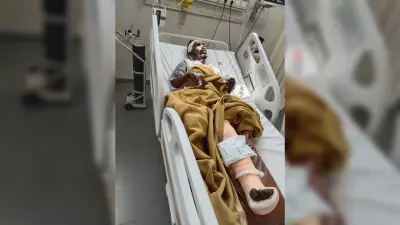Bokaro News : डोजर ग्रेडर मशीन की चपेट में आने से श्रमिक घायल, रेफर