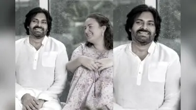 Pawan Kalyan की सर्जरी के बाद कैसी है तबीयत? पत्नी ने कहा- चिंता की कोई बात नहीं
