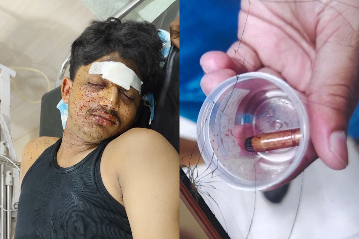 कोढ़ा के संदलपुर में देर रात ताबड़तोड़ गोलीबारी, युवक के सिर में लगी गोली, पांच संदिग्ध हिरासत में