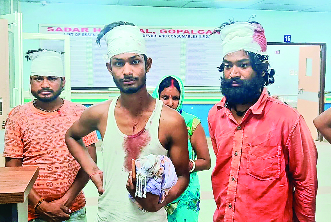 Gopalganj News : बैकुंठपुर में कथा मटकोर में गाना बजाने को लेकर दो पक्षों में मारपीट, 11 लोग घायल