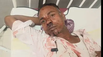 पारिवारिक कलह के बाद ससुर और बहू के बीच चाकूबाजी, दोनों अस्पताल में भर्ती