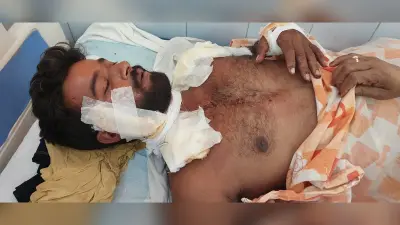 मुखबिरी के शक में युवक पर चाकू और तलवार से जानलेवा हमला