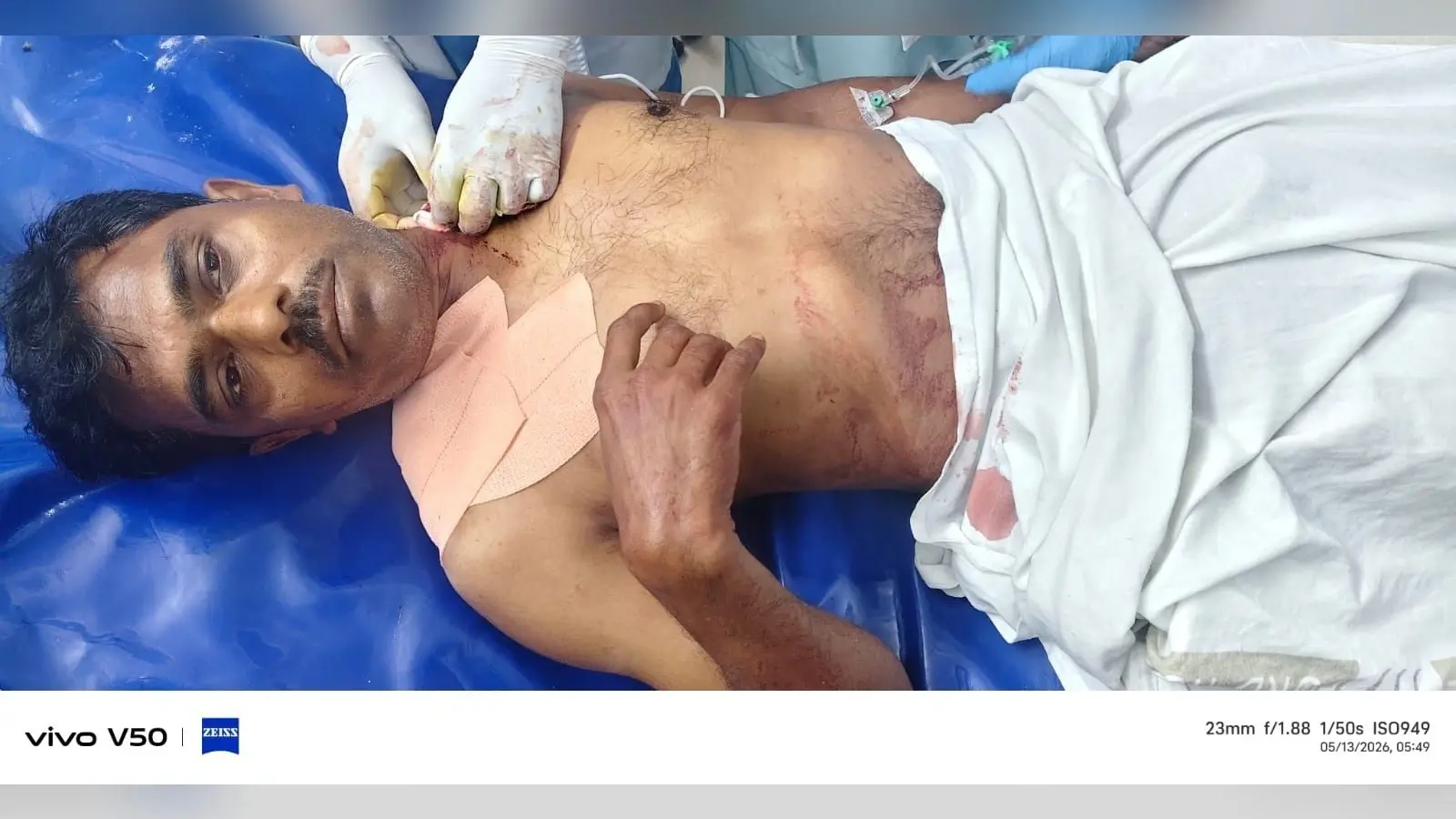 मोबाइल छीनने के विरोध पर शिक्षक को मारी गोली