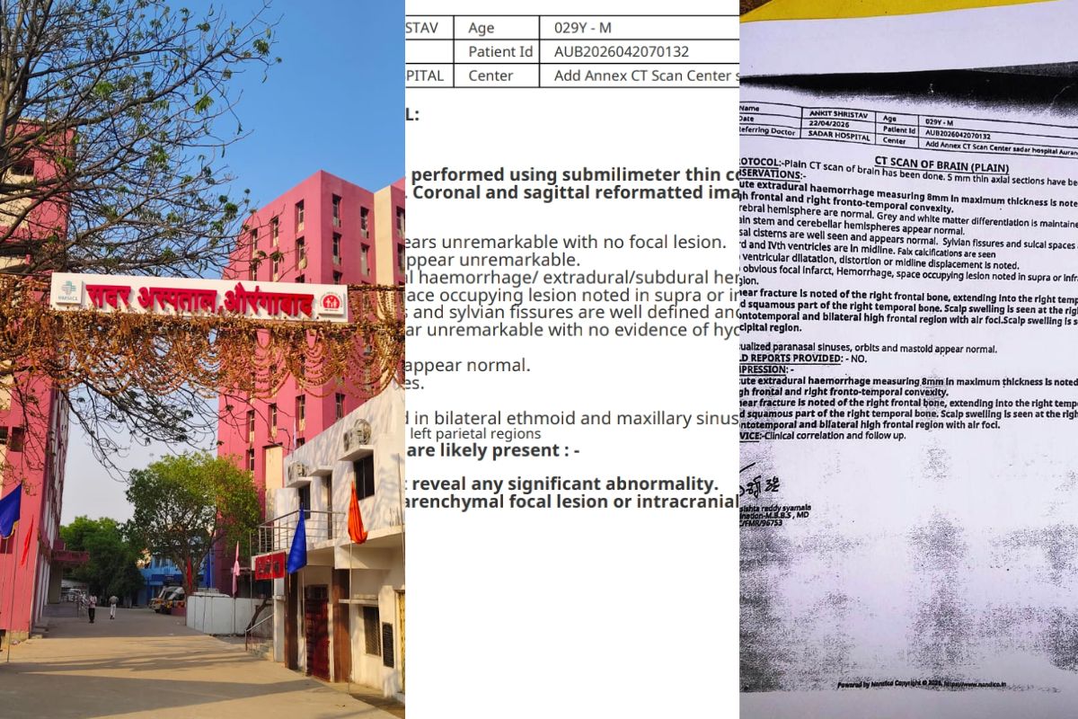 औरंगाबाद सदर अस्पताल में CT Scan रिपोर्ट में कथित फेरबदल, डीएम के निर्देश पर तीन सदस्यीय जांच टीम गठित
