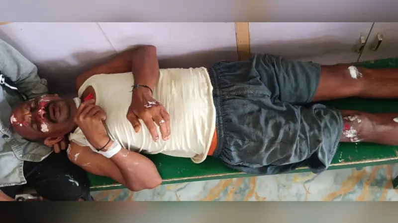 तेज रफ्तार का कहर: बाइक ने साइकिल सवार को मारी टक्कर, दोनों घायल