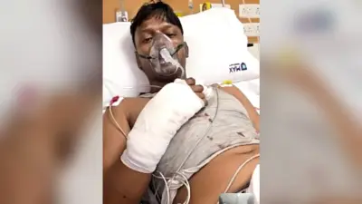 दिल्ली होटल हादसा के घायलों में शामिल पूर्णिया के युवक ने खिड़की से कूदकर बचायी थी जान