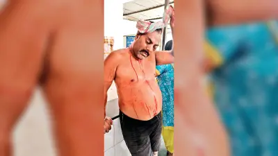 Rourkela News: मालगोदाम बस्ती में जमीन विवाद को लेकर दो परिवारों में मारपीट, एक व्यक्ति घायल