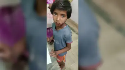 सियार के हमले में बच्ची गंभीर घायल, दुर्घटना में महिला जख्मी