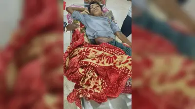 आम तोड़ने के दौरान पेड़ से गिरा छात्र, एमजीएम में इलाजरत