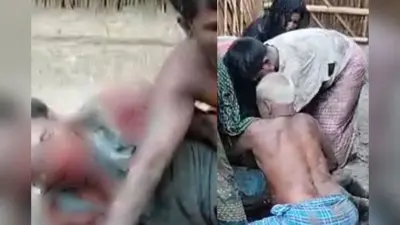 वैशाली में आपसी विवाद में चाचा ने लोहे की रॉड से भतीजे का फोड़ा सिर, 3 गिरफ्तार