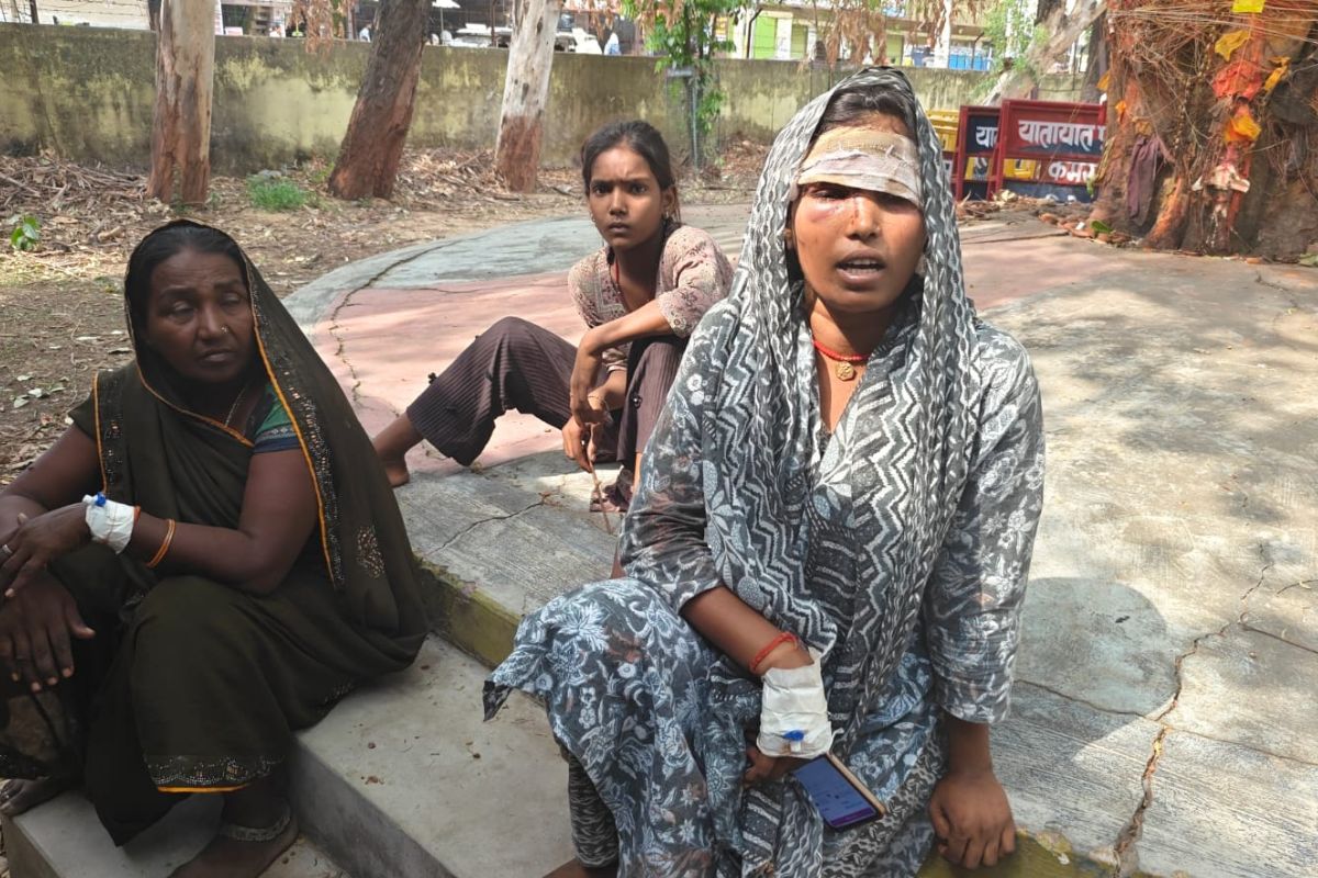 आपसी विवाद में महिला को लाठी-डंडों से पीटा, फटा सिर; 2 दिन तक FIR नहीं हुई दर्ज, SP ने थानेदार को लगाई फटकार