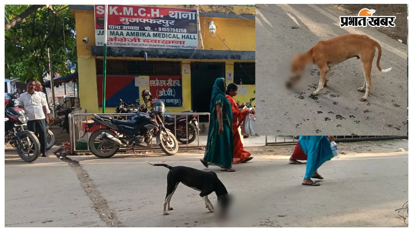SKMCH परिसर में आवारा कुत्तों के मुंह में दिखा मानव अवशेष, अस्पताल की सुरक्षा पर उठे बड़े सवाल