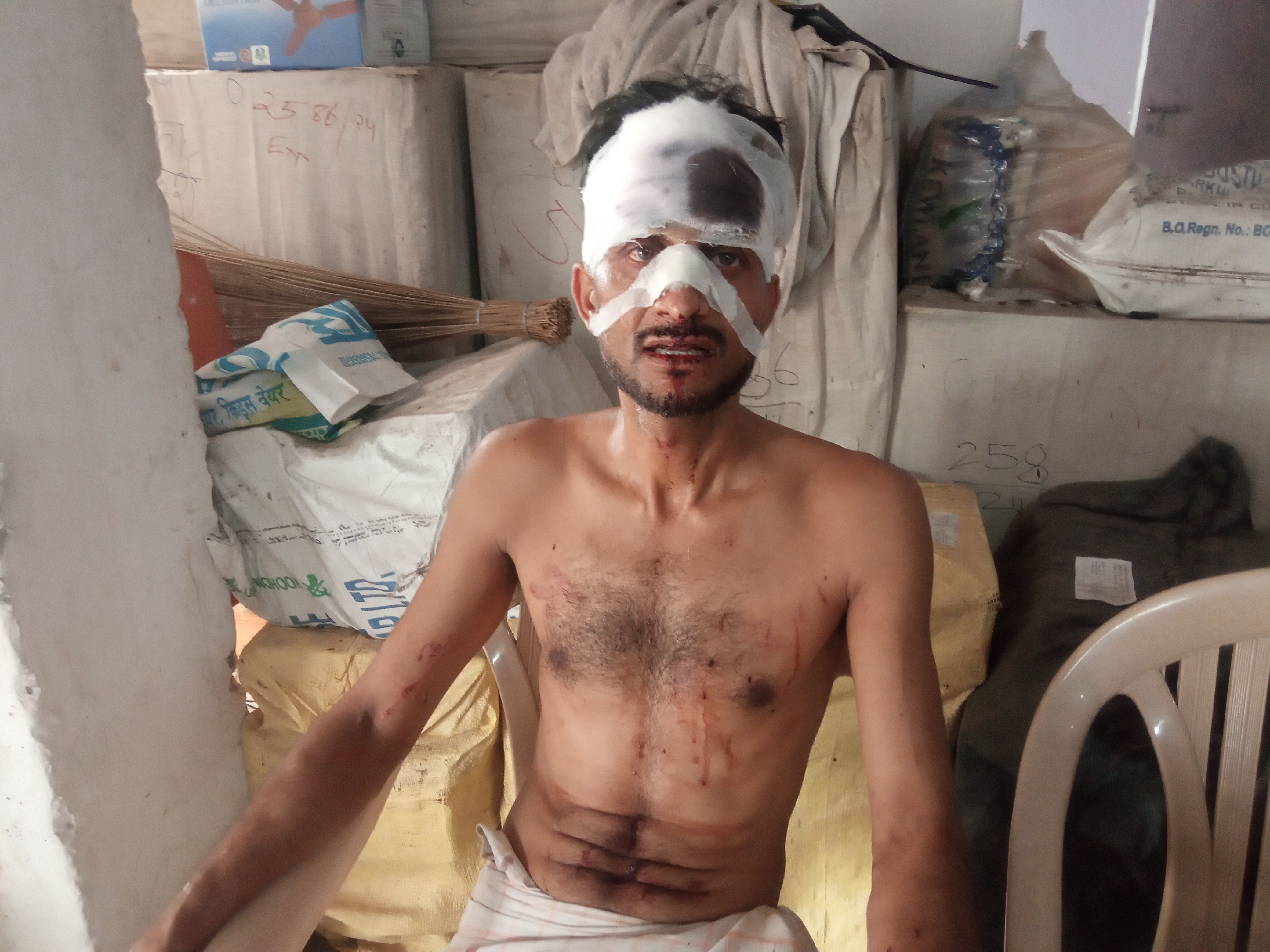 बक्सर में घरेलू विवाद ने लिया खूनी मोड़, बड़े भाई ने लोहे की रॉड से छोटे भाई का फोड़ा सिर