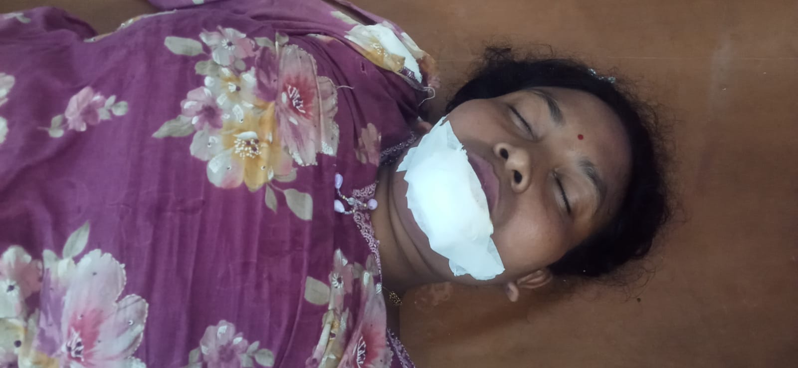 बस की टक्कर से ई-रिक्शा पर सवार सात यात्री घायल, दो गंभीर