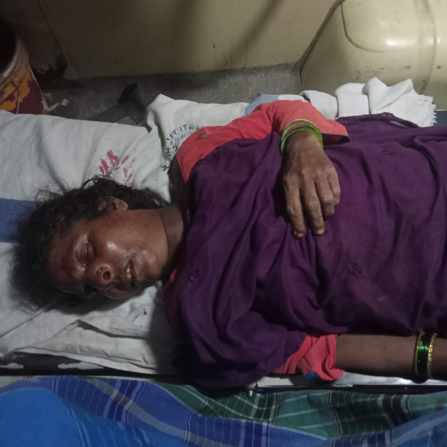 भवानीपुर में तेज रफ्तार बाइक ने महिला को मारी जोरदार टक्कर: चालक और महिला दोनों जख्मी