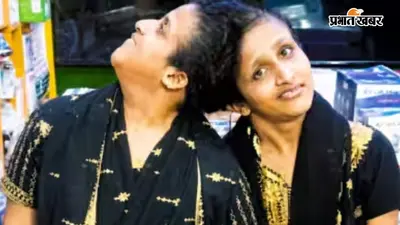 तीन महीने बाद सबा-फराह को मिली जरूरी दवाएं, अब हर महीने बिहार के विशेषज्ञ डॉक्टरों की टीम करेगी स्वास्थ्य जांच