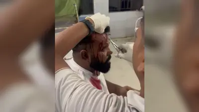 मानपुर में मशीन लिफ्टिंग के विवाद में पहले क्रेन संचालक से थाना में हुआ समझौता, कुछ घंटे बाद ही पीड़ित पर हमला कर लूट