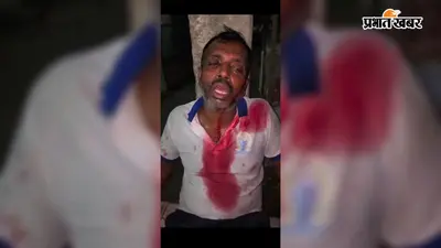 जमीन के टुकड़े के लिए मारपीट, दो लोग घायल, 13 लोगों पर कार्रवाई की मांग