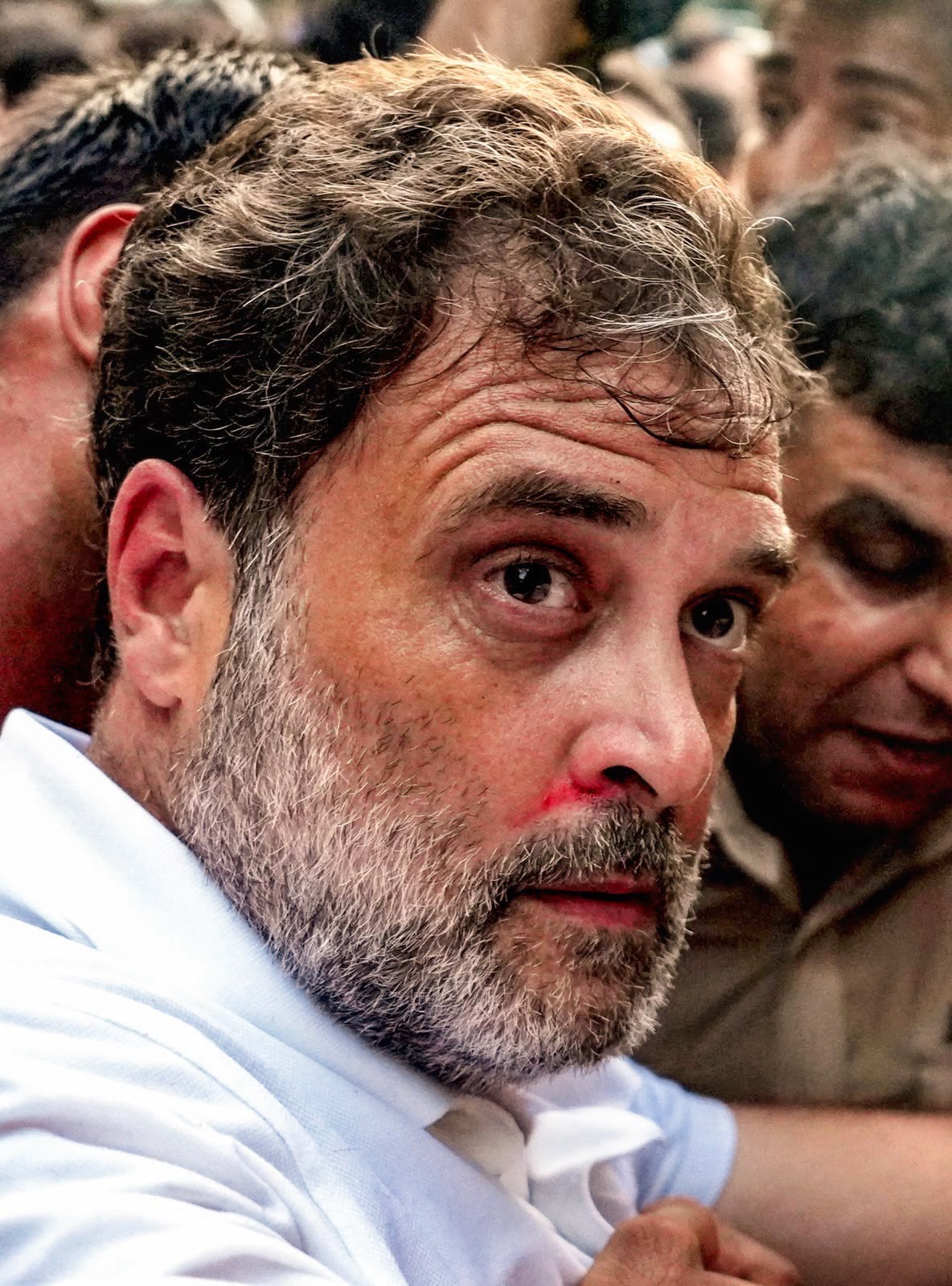 राहुल के तीखे तेवर, चेहरे पर लगी चोट