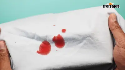 कपड़ों पर लग गए हैं खून के दाग? इन आसान घरेलू उपायों से मिनटों में करें साफ