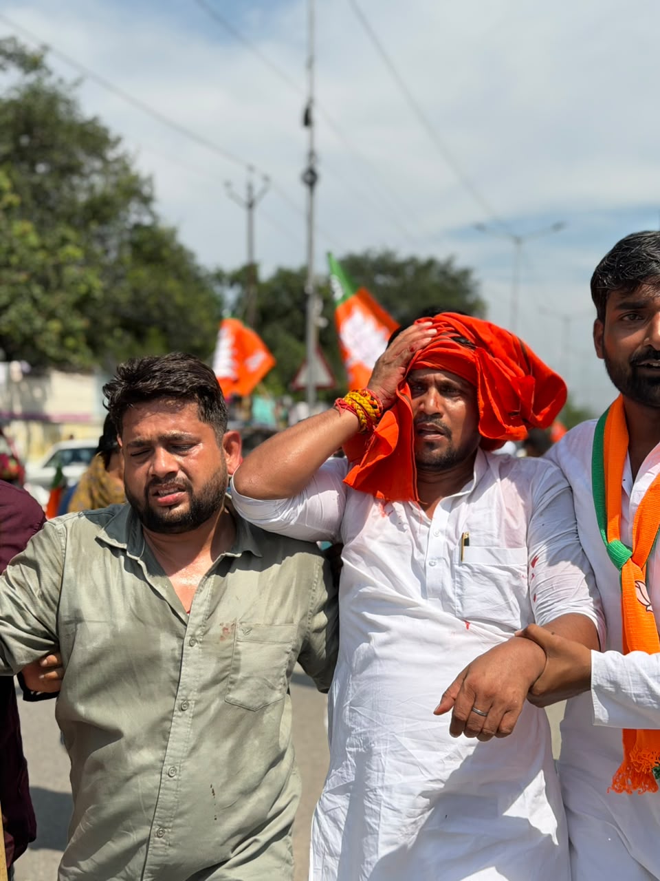 झड़प में बीजेपी कार्यकर्ता घायल