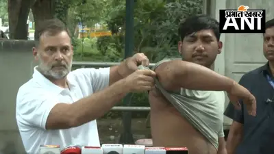 राहुल गांधी ने घायल छात्र से की मुलाकात, बोले- तिरंगा लेकर कर रहा था प्रदर्शन पुलिस ने चलाई पैलेट गन