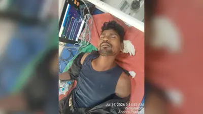 काम की तलाश में गोवा जा रहे मजदूर ट्रेन से गिरा, पैर कटा