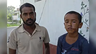 हाजीपुर के महुआ में स्कूल जा रहे 9 वर्षीय छात्र को बाइक ने मारी टक्कर, मुंह नाक और सिर में आई गंभीर चोटें