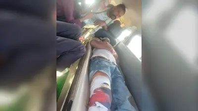 एनएच-80 पर बाइक का टायर फटा, दो युवक गंभीर रूप से घायल; एक पटना रेफर