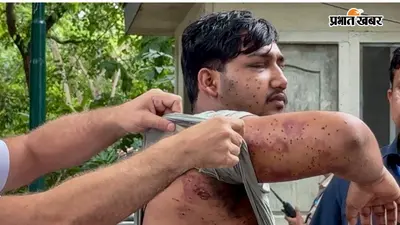 CJP Protest : संसद मार्च के दौरान RAF जवान ने दागीं 7 पेलेट गोलियां, 5 प्रदर्शनकारी घायल