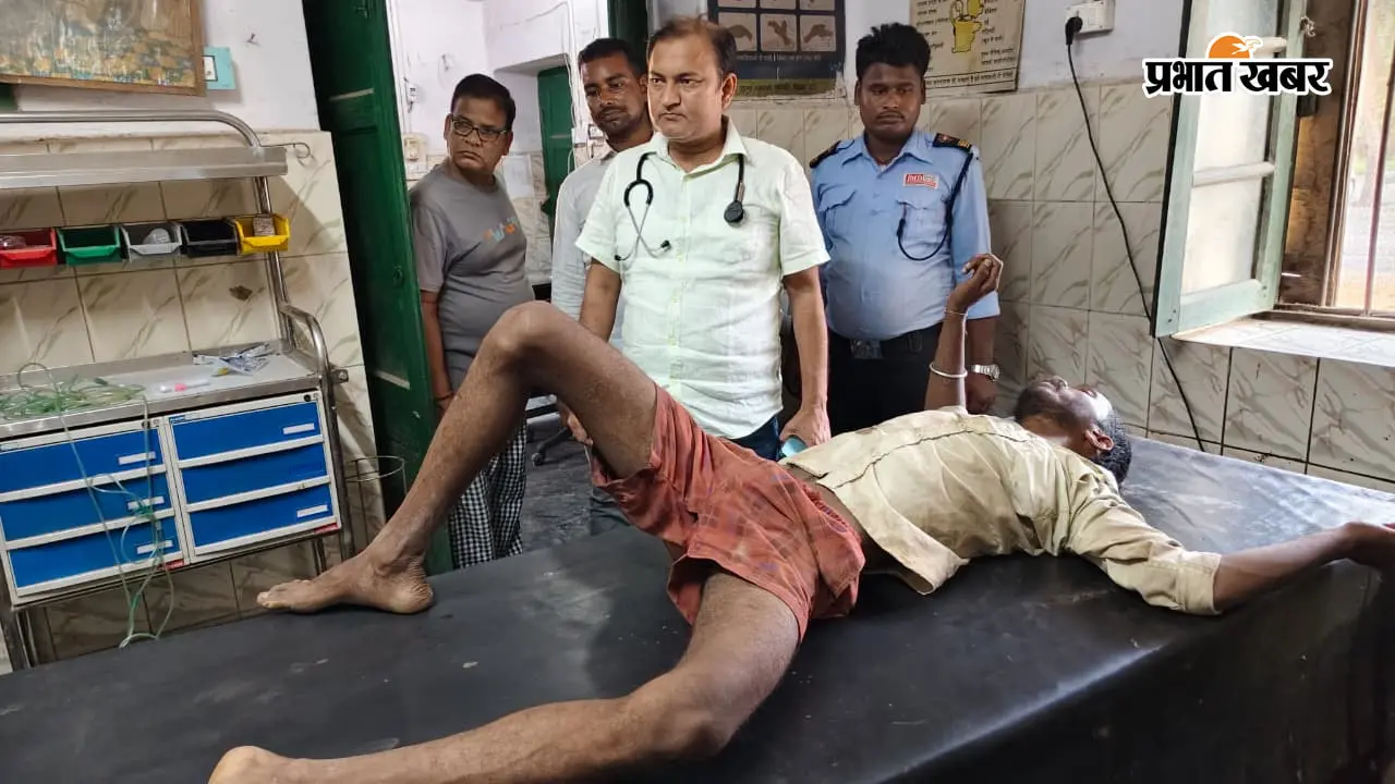 33 हजार वोल्ट की हाईटेंशन लाइन बनी जानलेवा, पेंटिंग कर रहे दो मजदूर गंभीर रूप से झुलसे, हायर सेंटर रेफर