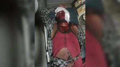 रोहतास: स्कॉर्पियो की टक्कर से बाइक सवार 3 युवक गंभीर रूप से घायल, एक की हालत चिंताजनक, सासाराम रेफर