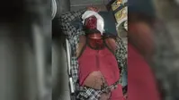 रोहतास: स्कॉर्पियो की टक्कर से बाइक सवार 3 युवक गंभीर रूप से घायल, एक की हालत चिंताजनक, सासाराम रेफर