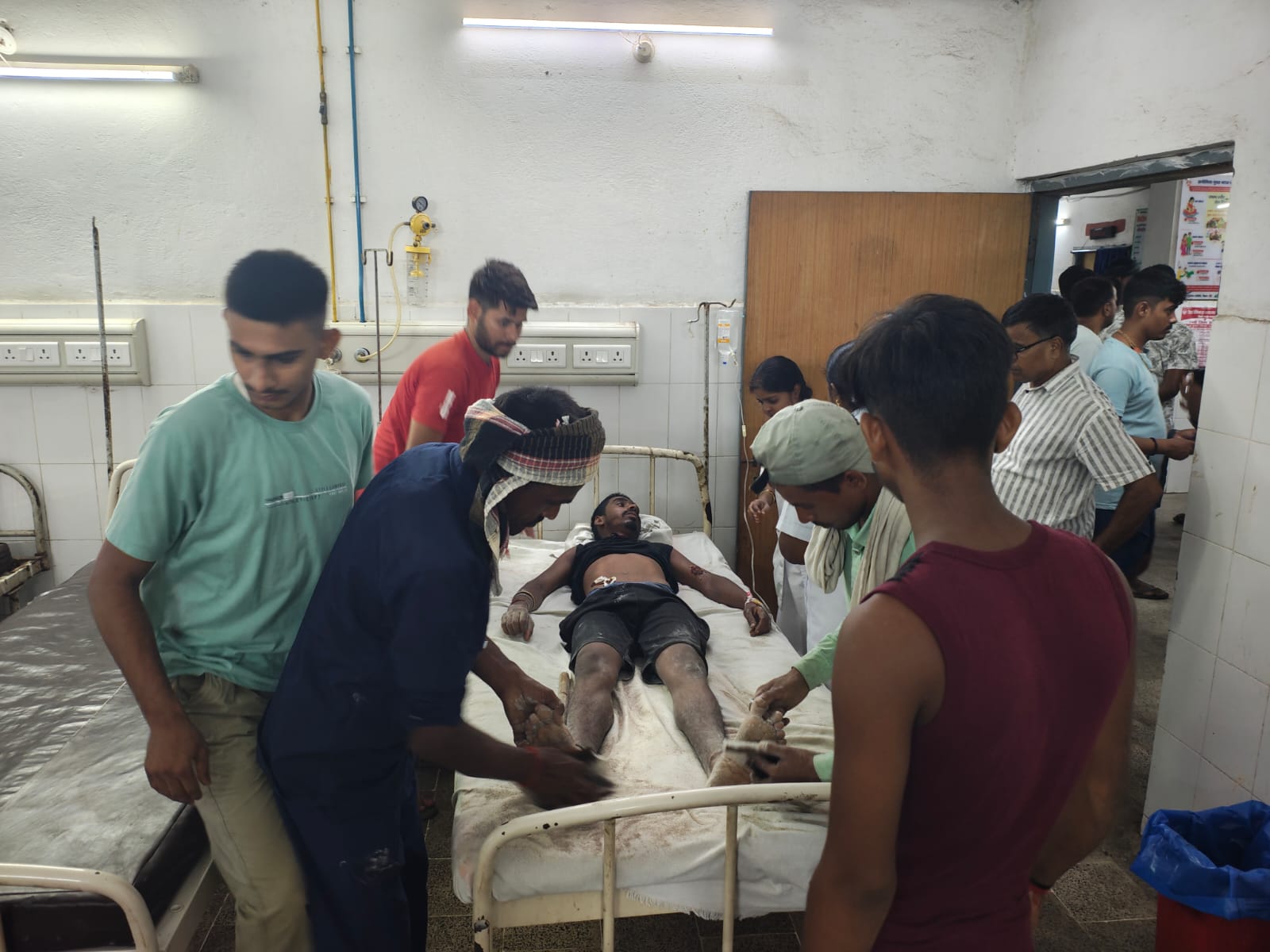 शटडाउन के बावजूद पोल पर चढ़ा सोलर मिस्त्री, करंट की चपेट में आने से झुलसा